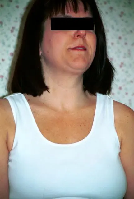 Wil image 0